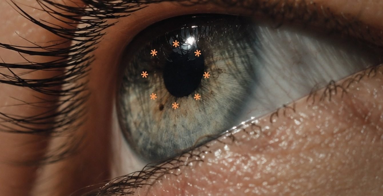 Fotografía de un ojo con marcas de observación alrededor de la pupila