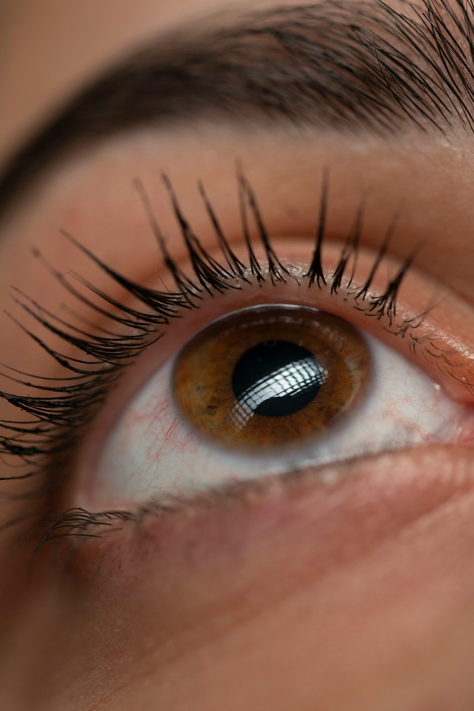 IRIS.1